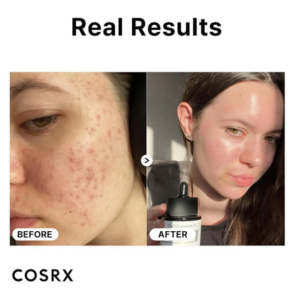 [Cosrx] The Niacinamide 15 Serum 20ml vtgigy-cx